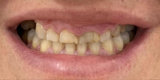 Prova social 1 antes Prova social 1 antes