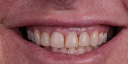 Prova social 2 antes Prova social 2 antes