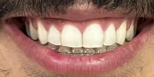 Prova social 3 antes Prova social 3 antes