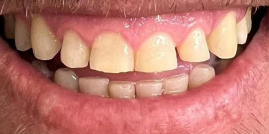 Prova social 4 antes Prova social 4 antes